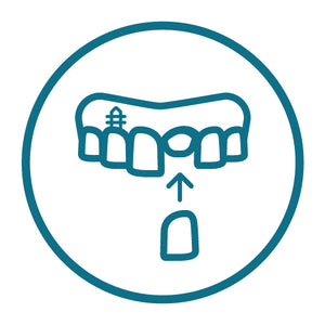 Veneers - Veneera_Icon_Kronen_und_Implantate