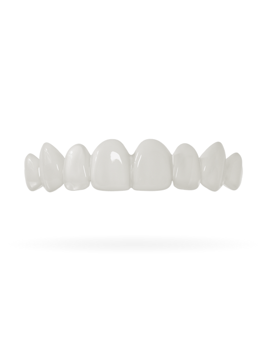Zahn-Veneer 2.0