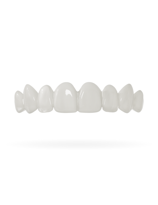 Veneera-Zahn-Veneers-Zahn-VeneerObenNaturweiss