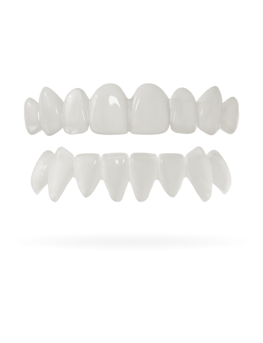 Veneera-Zahn-Veneers-Zahn-VeneerObenUntenNaturweiss-min