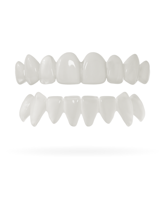 Zahn-Veneer 2.0