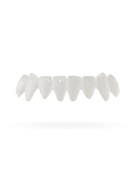 Veneera-Zahn-Veneers-Zahn-VeneerUntenNaturweiss-min